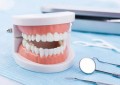 拥有自信笑容的第一步牙齿矫正，牙齿矫正大概要花费多少钱？
